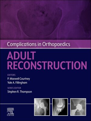 cover image of Complications in Orthopaedics